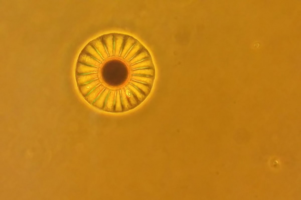 phytoplankton