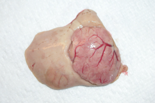 Liver