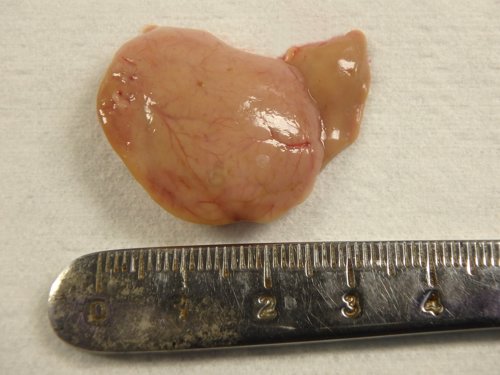 The image shows a common dab liver with a large cancerous neoplasm, next to a scale. 