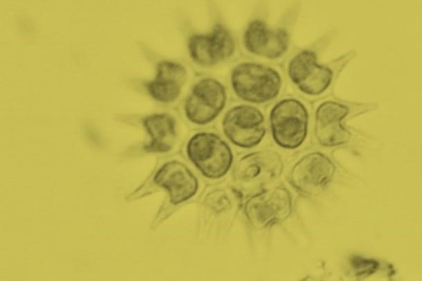 biomass under microscope